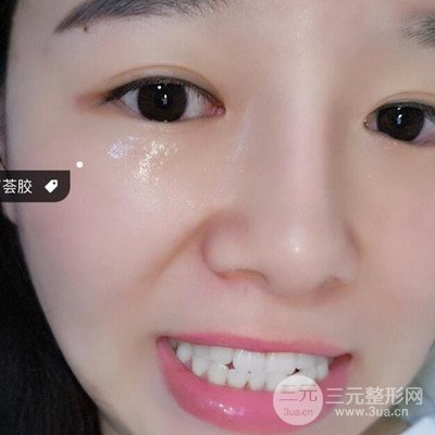 做了牙齒冷光美白果很棒，綻放美麗笑容
