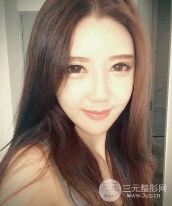 全臉自體脂肪填充手術(shù)日記分享，改良臉型年輕十歲