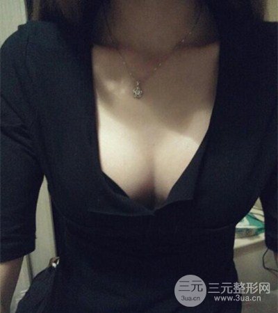 平胸妹做了假體隆胸果分享，豐滿身材不是夢