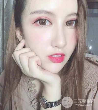 隆鼻整形手術(shù)個人經(jīng)歷分享，精致小翹鼻不是夢