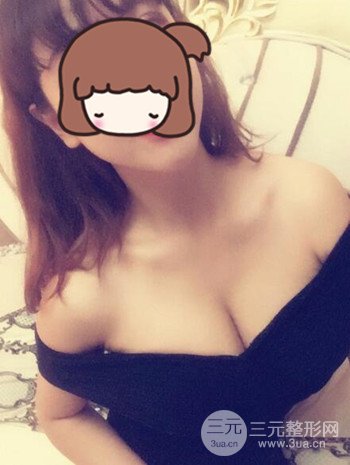 假體隆胸術后成功擺脫小學生身材，立現性感身材