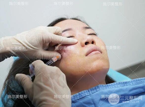 南京施爾美玻尿酸注射案例,讓蘋果肌嘭嘭嘭！