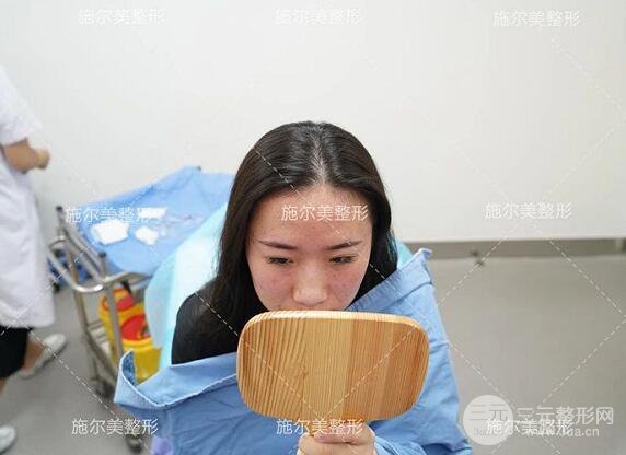 南京施爾美玻尿酸注射案例,讓蘋果肌嘭嘭嘭！