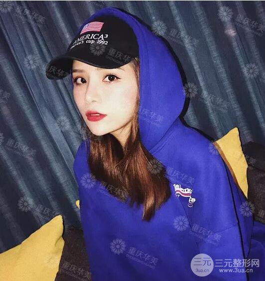 重慶萬州華美潘寶華雙眼皮+內眼角前后對比圖被贊氣質港風女神!