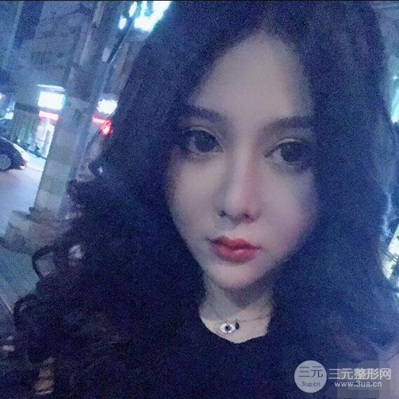 昆明吳氏嘉美李明硅膠隆鼻前后對比圖恢復(fù)心情小札