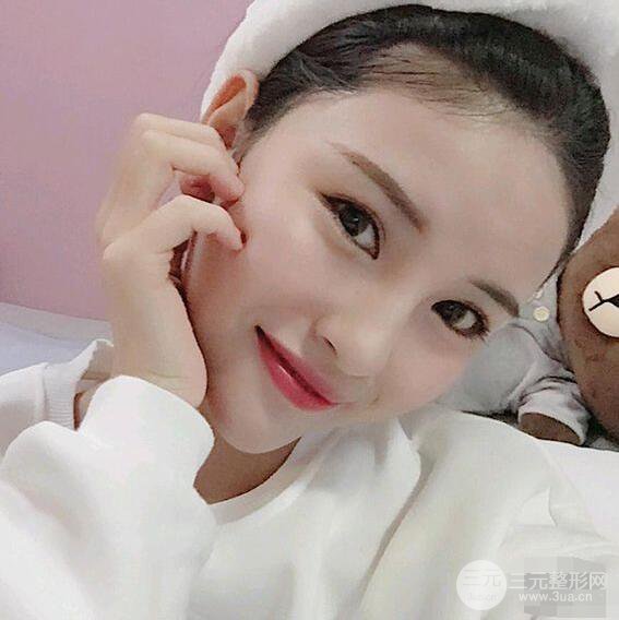 成都華西醫(yī)院整形美容科卿勇隆鼻整形前后對(duì)比圖恢復(fù)心情小札