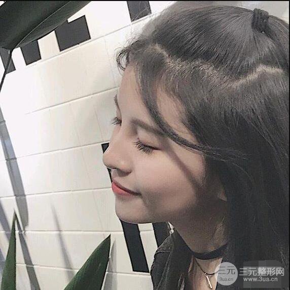 成都華西醫(yī)院整形美容科卿勇隆鼻整形前后對(duì)比圖恢復(fù)心情小札