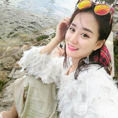 廣州韓妃李光琴隆鼻失敗修復(fù)前后對比圖分享！