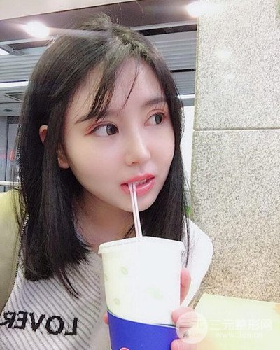貴陽華美田永成隆鼻整形前后對比圖分享