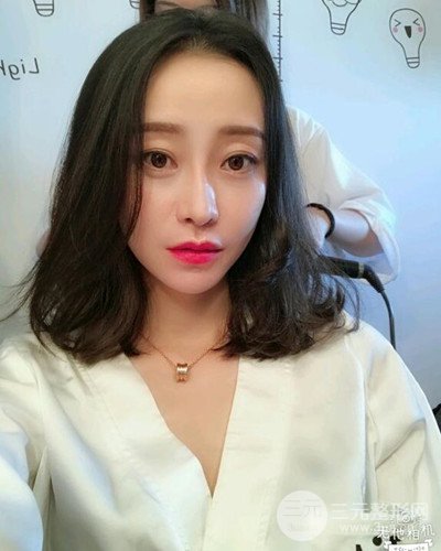 北京雍禾韓巖發(fā)際線種植手術(shù)半年了，分享前后果圖片~