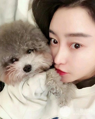 北京雍禾韓巖發(fā)際線種植手術(shù)半年了，分享前后果圖片~