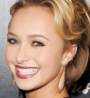 四川E光嫩膚除皺的果怎么樣