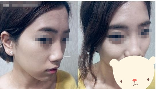 豐面頰后整個人看起來都精神好多