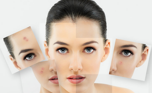 四川E廣嫩膚祛痘有什么優(yōu)勢