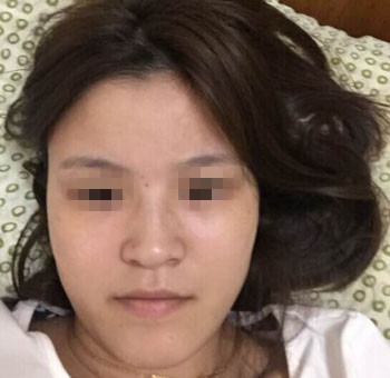整成瓜子臉需要多少錢價(jià)格 整形瓜子臉需要多少錢價(jià)格 整個(gè)瓜子臉需要多少錢價(jià)格
