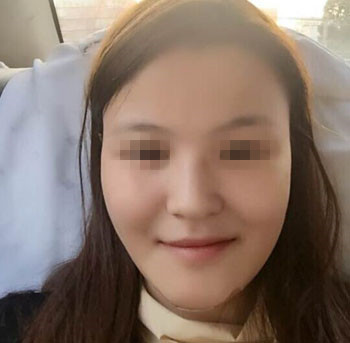 整成瓜子臉需要多少錢價(jià)格 整形瓜子臉需要多少錢價(jià)格 整個(gè)瓜子臉需要多少錢價(jià)格