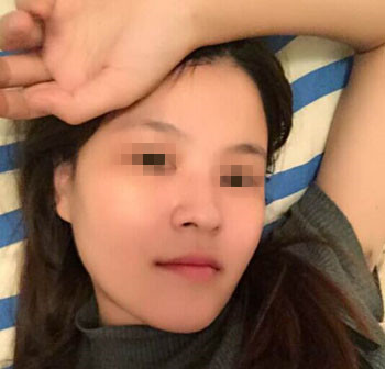 整成瓜子臉需要多少錢價(jià)格 整形瓜子臉需要多少錢價(jià)格 整個(gè)瓜子臉需要多少錢價(jià)格