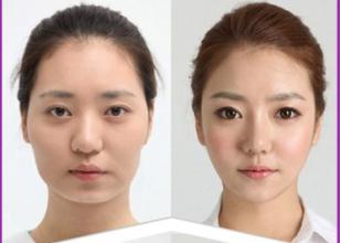 【打B****】打B****的副作用 打B****有多大的危害
