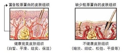 什么是膠原蛋白,膠原蛋白的作用