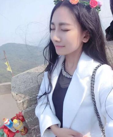 南京維多利亞整形醫(yī)院做自體脂肪隆鼻好不好