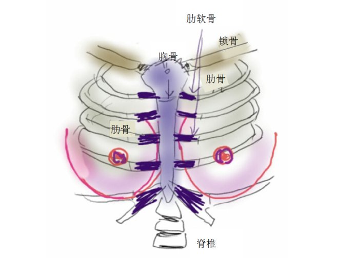 鄭州,雞胸,整形,手術(shù),多少錢