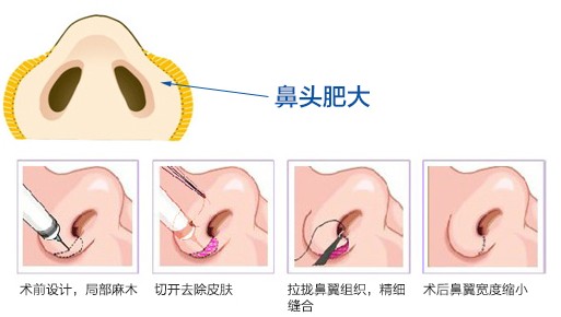 上海華美醫(yī)療美容醫(yī)院2017價格表新預覽