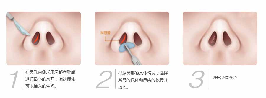 成都駐顏整形醫(yī)院全新價格表一覽出爐