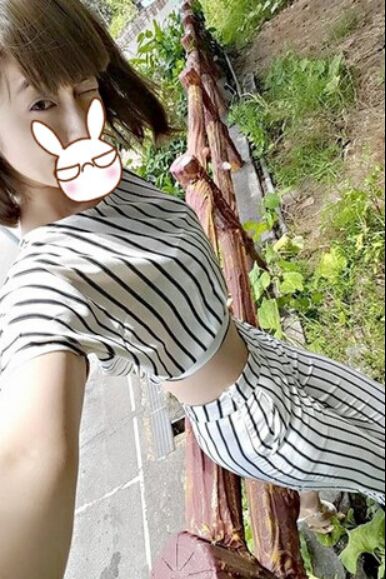 吸脂瘦大腿讓我變回纖纖細(xì)腿