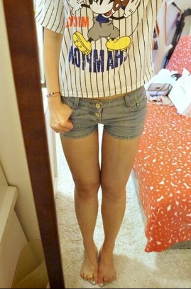 吸脂瘦大腿讓我變回纖纖細(xì)腿