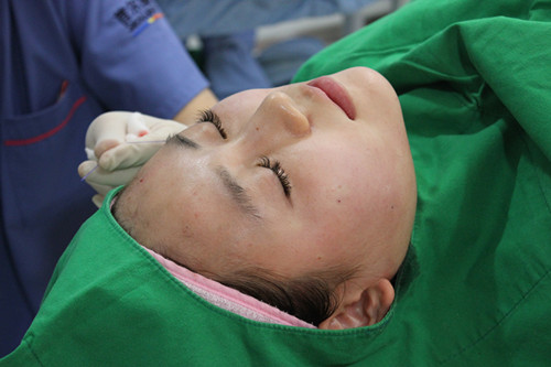 我做高強(qiáng)度聚焦超聲面b提升真實(shí)經(jīng)歷 繼續(xù)做我的少女