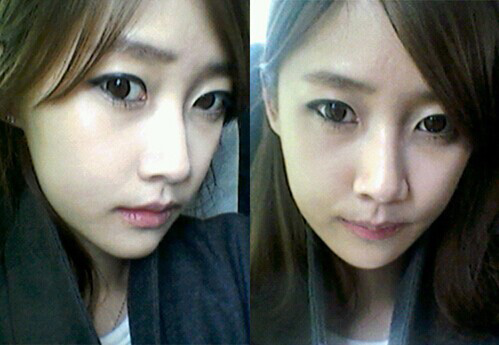 在北京藝星醫(yī)療美容醫(yī)院做下頜角整形手術(shù)真實(shí)經(jīng)歷