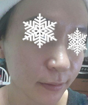 北京禾美嘉彩光嫩膚 果不錯哦~