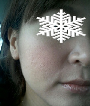 北京禾美嘉彩光嫩膚 果不錯哦~