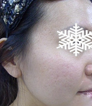 北京禾美嘉彩光嫩膚 果不錯哦~