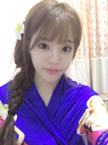 北京禾美嘉注射玻尿酸豐唇+豐臥蠶 讓我更美啦~