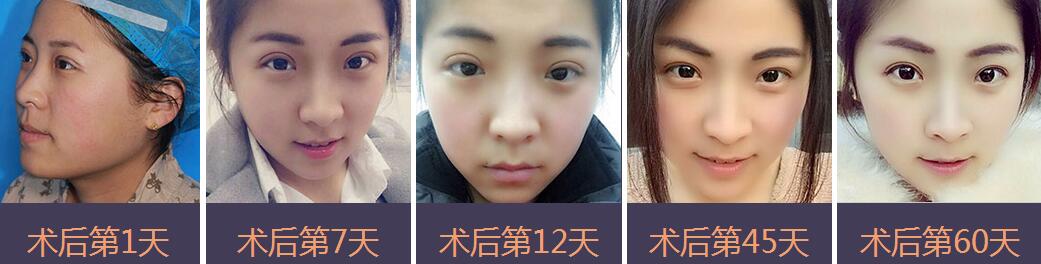 手術(shù)恢復(fù)過(guò)程