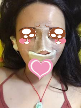 膨體隆鼻公改變了我塌鼻子的命運(yùn)
