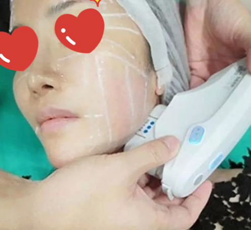 做了拉皮除皺 我的皮膚越來越緊致光滑了