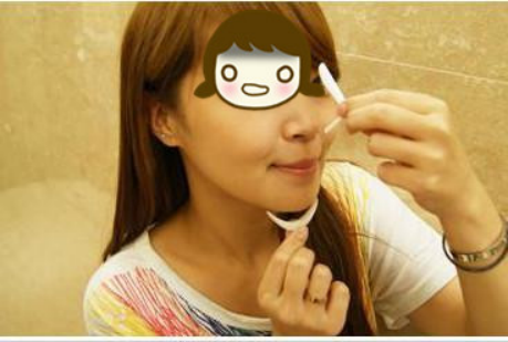 膨體隆鼻讓我的顏值更上一層