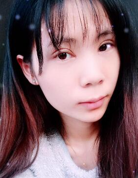 長沙美之峰重瞼+開眼角恢復(fù)過程圖