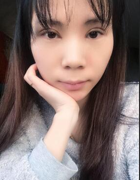 長沙美之峰重瞼+開眼角恢復(fù)過程圖
