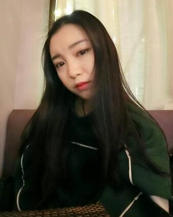 長(zhǎng)沙美之峰割雙眼皮3個(gè)月了