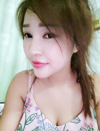 長沙美之峰隆鼻整形手術(shù)恢復日記圖