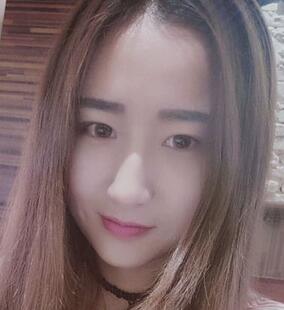 武漢中愛(ài)自體脂肪豐臥蠶日記