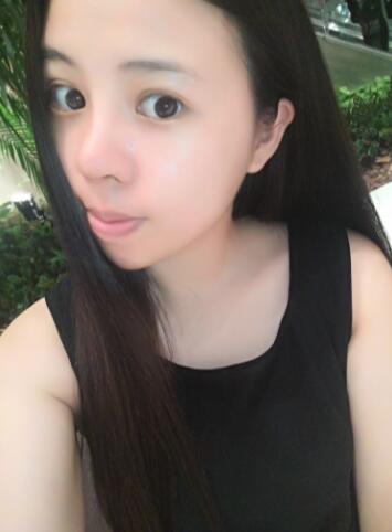 隆鼻整形真實恢復(fù)期圖片 隆鼻整形一個月了