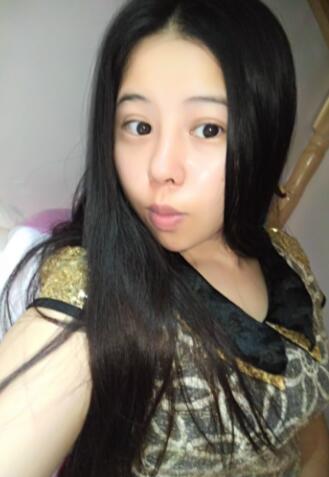 隆鼻整形真實恢復(fù)期圖片 隆鼻整形一個月了