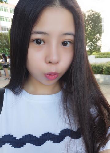 隆鼻整形真實恢復(fù)期圖片 隆鼻整形一個月了