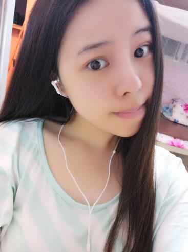 隆鼻整形真實恢復(fù)期圖片 隆鼻整形一個月了