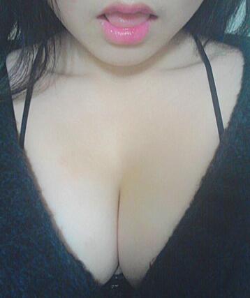 鄭州悅美假體隆胸2個月 果自然