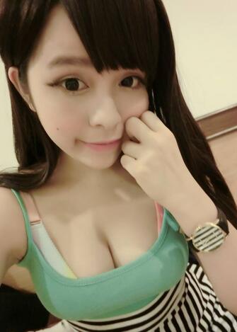 鄭州悅美假體隆胸2個月 果自然